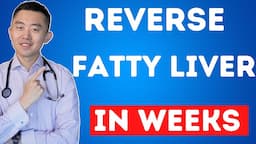 The FASTEST Way to Reverse Fatty Liver, Naturally | NAFLD Treatment