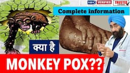 Monkeypox Virus : Symptoms, Transmission, Vaccine & Treatment | Complete Information | Dr.Education