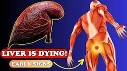 LIVER is DYING! 12 Weird Signs of LIVER DAMAGE | Health care