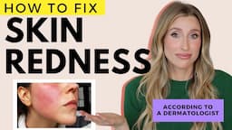 Fix Redness on the Face and Body | Dr. Sam Ellis