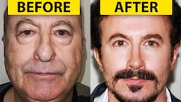 INSANE Plastic Surgery Results - Real or FAKE?