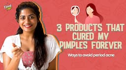 3 Products That Cured My Pimples Forever | Kiraak Style | Chai Bisket