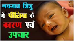 नवजात शिशु में पीलिया के कारण एवं उपचार | Newborn Jaundice