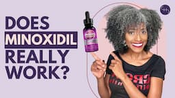 The SHOCKING Truth about Minoxidil for Hair Loss