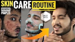 EASY & BEST Skin Care Routine For BOYS & MEN | Remove Acne, Pimples & Darkspots FAST 🔥🔥