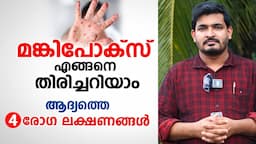 മങ്കിപോക്സ്‌ എങ്ങനെ തിരിച്ചറിയാം ആദ്യ രോഗ ലക്ഷണങ്ങൾ | Monkeypox symptoms | Dr Basil Yousuf