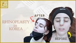 Getting Rhinoplasty in Korea | Seoul Guide Medical | #nosefillers #nosesurgery