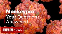 Monkeypox: Your Questions Answered