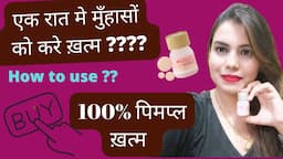 एक रात में पिंपल कैसे खत्म करें? How do you get rid of pimples instantly? 100% Remove Pimple , Scars