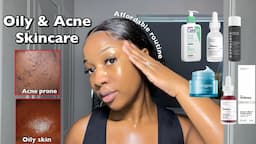 SKINCARE ROUTINE FOR OILY ACNE-PRONE SKIN | A routine for smooth & clear Skin ‼️