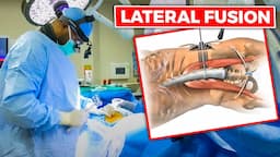 INSIDE THE OR: Lateral Lumbar Interbody Fusion (LLIF) w/percutaneous screws