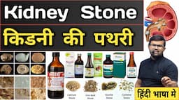 kidney Stone | किडनी की पथरी | Treatment | Medicine | Syrup | Kidney Stone Syrup | Medicine Use