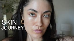 everything I have done to have consistent good skin | Melissa Alatorre