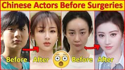 Chinese Actors Before and After Plastic Surgeries 😮 , Incredible Changes, Chinese Drama