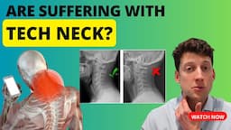 What is "tech neck" and how to FIX it?