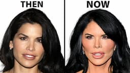 Lauren Sanchez's NEW FACE | Plastic Surgery Analysis