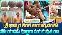 Psoriasis | Sri Bhaskara Kerala Ayurvedic Hospital సోరియాసిస్ పూర్తిగా నయమవుతుంది.. TeluguOne Health