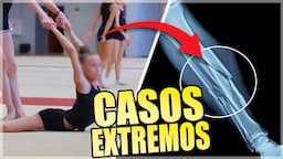 El LADO OSCURO de la GIMNASIA en NIÑOS