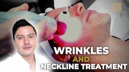 Laser Treatment for Wrinkles and Necklines with the CEO |  Seoul Guide Medical | #lasertreatment