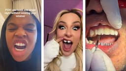 Tiktok Teeth Trends Gone WRONG!