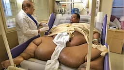 10 लोग जो मोटापे का शिकार हो गए , Top 10 Fattest People