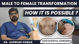 Male To Female Transformation | Sex Change, Breast, Sex Reassignment Surgery | MtF Transition |#mtf