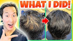 How I Treated My Thinning Hair the Holistic Way!