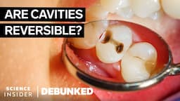 Dentists Debunk 15 More Teeth Myths | Debunked