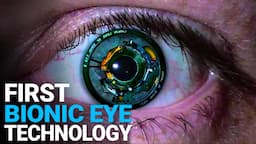 The Worlds First Bionic Eye Will Cure Blindness, New Technologies CHANGE the WORLD, Cool Technology