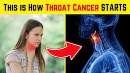 This is How Throat Cancer STARTS and No One Tells You - 10 Symptoms