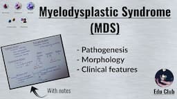 Myelodysplastic Syndrome | MDS || Pathology