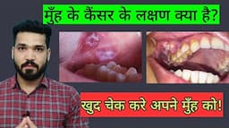 मुँह के कैंसर के लक्षण? mouth cancer symptoms, Don't ignore if symptoms seen