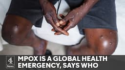 Mpox: First case of contagious variant outside Africa reported