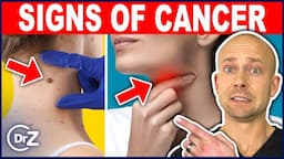 10 Warning Signs Of Cancer You MUST Know About