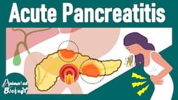 Acute Pancreatitis | Pathology and treatment of Acute Pancreatitis | USMLE step 1