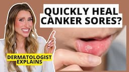 Quickly Heal Canker Sores: How to Prevent & Heal Them Faster | Dermatologist Explains