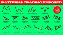 Ultimate Chart Patterns Trading Course (EXPERT INSTANTLY)