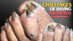 Challenges of Having Diabetes