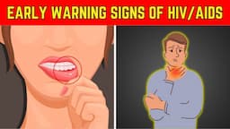 Identify The Early Signs Of HIV AIDS | 10 Signs Of HIV Positive