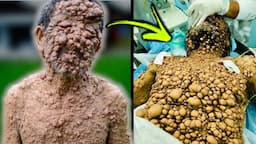 The Most Unusual People With Bizarre Skin Conditions