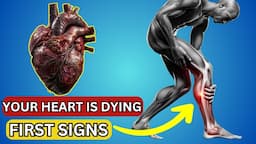 HEART IS DYING! 12 Weird Signs Of HEART DAMAGE | Health