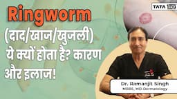 Ringworm (दाद/खाज/खुजली): ये क्यों होता है? कारण और इलाज! | Fungal Infections | Dr Ramanjit Singh