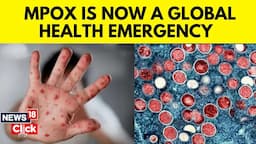 Monkey Pox Emergency News | Monkey Pox Virus In Africa | WHO Declares Global Health Emergency | N18G