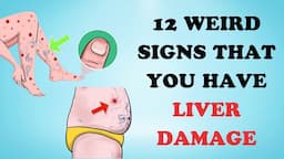 Warning: 12 Weird Signs That Show You're Having Liver Damage