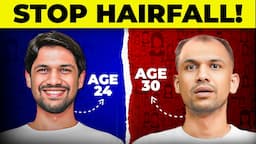 How to STOP HAIRFALL? | Causes and Solutions Explained | Saurabh Bothra