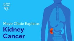 Mayo Clinic Explains Kidney Cancer