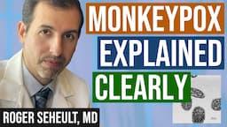 Monkeypox (Mpox) Explained Clearly