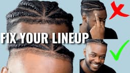 FIX YOUR LINEUP! | 5 Steps To Transform Your Hairline! 🔥