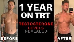 1 YEAR ON TRT - Testosterone Levels : Before & After