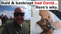 Youtuber Bald and Bankrupt Had Coronavirus... Here is Why